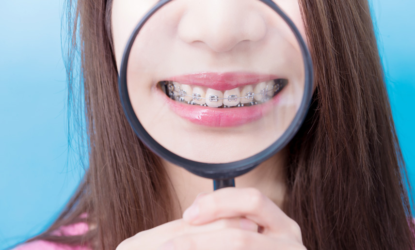 Clear vs metal braces: Which is right for you?